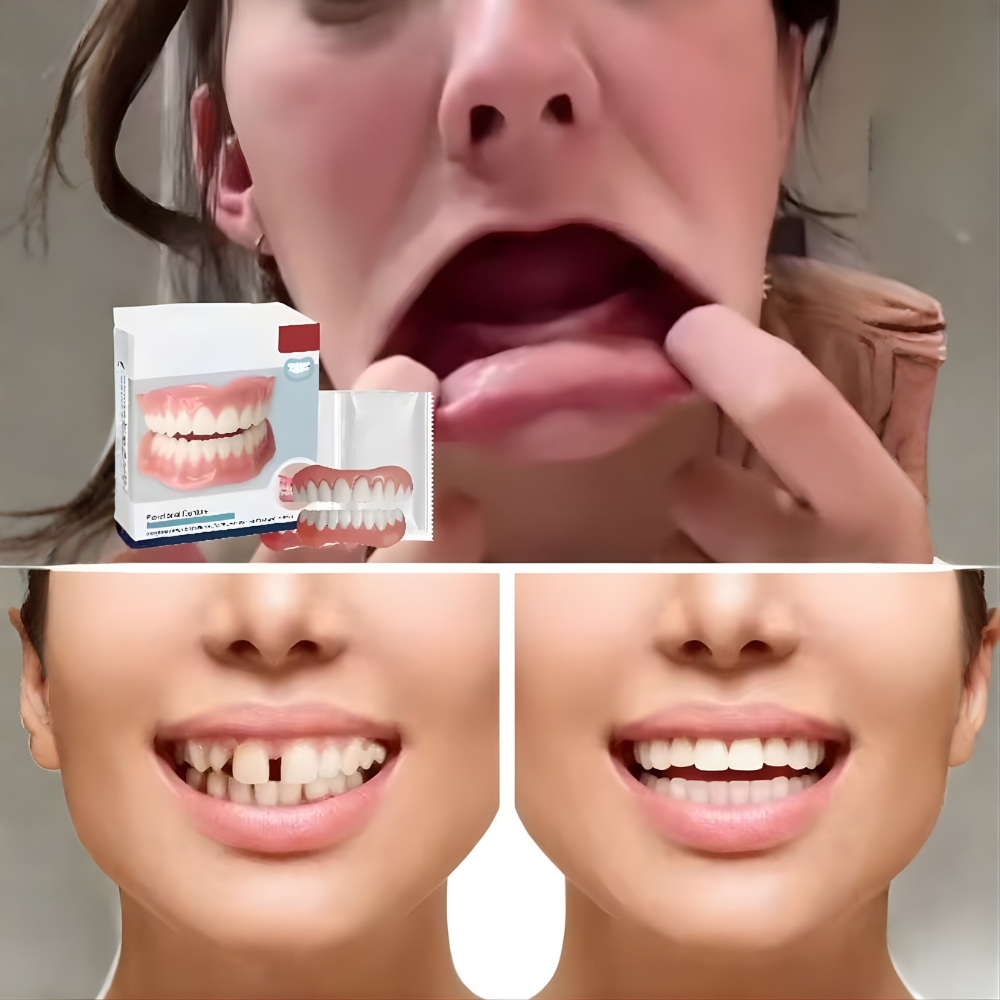 Dentivo™ - Schnappprothese Satz