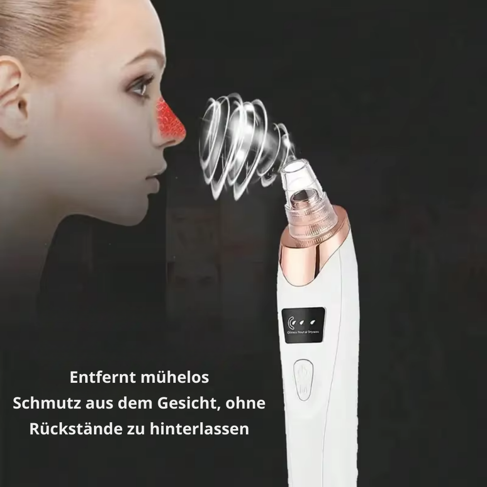 PoreLuxe™ - Gesichts Mitesser Entferner Vakuum