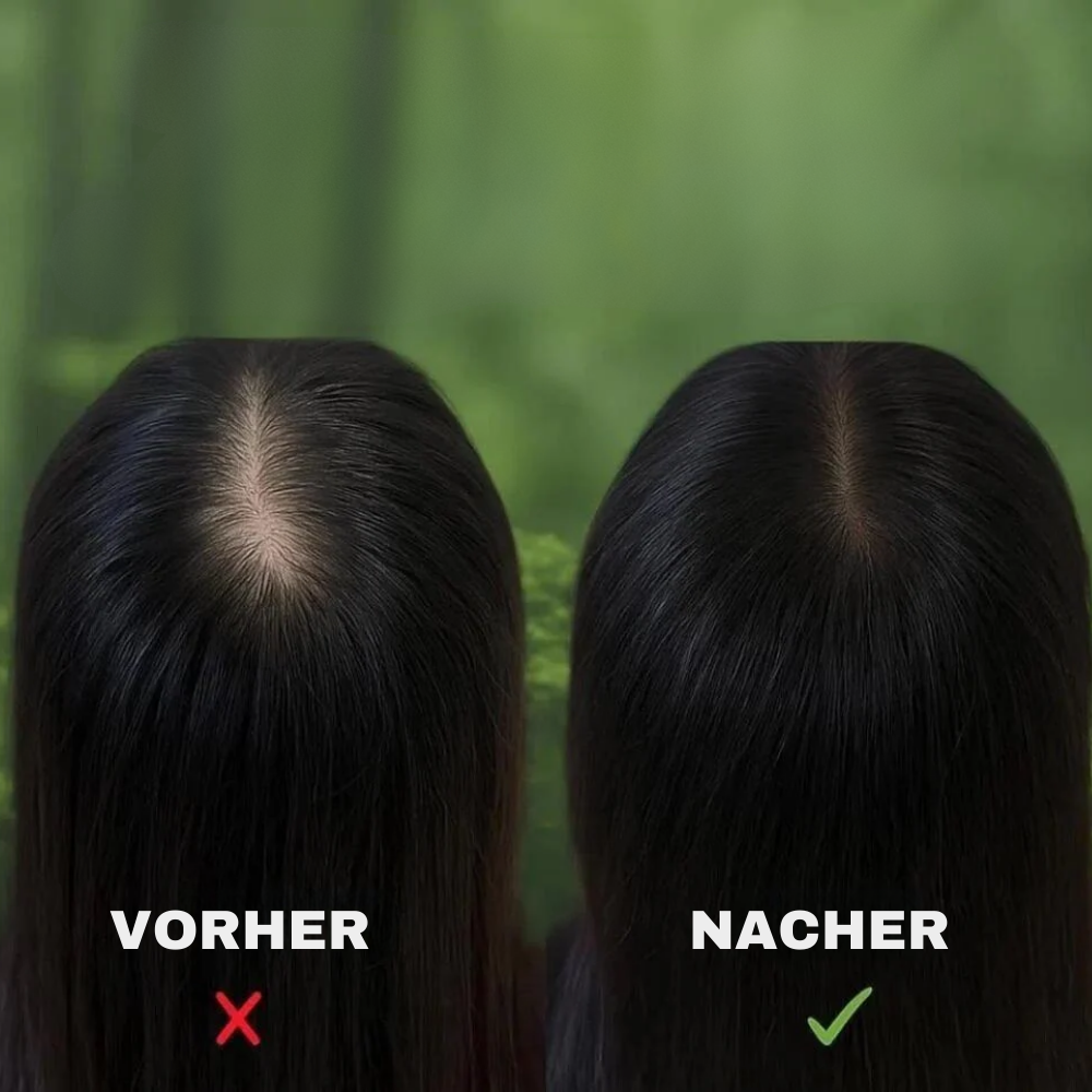 Herbalo™ - Kräuter Anti-Haarausfall Shampoo Seife