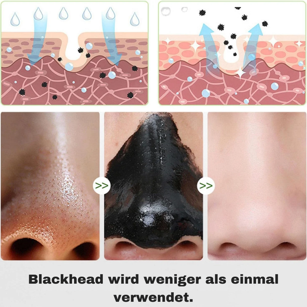 PealClean™ - Aktivkohle Peel-Off Gesichtsmaske