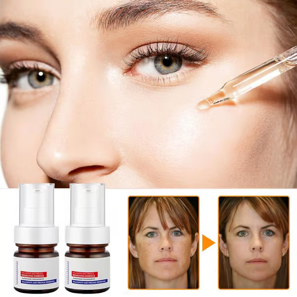 SpotLuxe™ - Serum zur Entfernung dunkler Flecken (1+1 GRATIS)