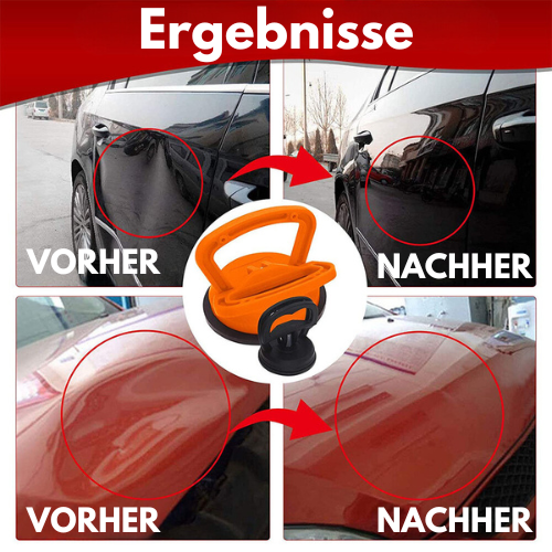 DentMaster™ - Saugnapf für Dellen im Auto