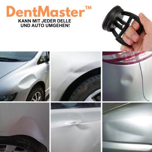 DentMaster™ - Saugnapf für Dellen im Auto