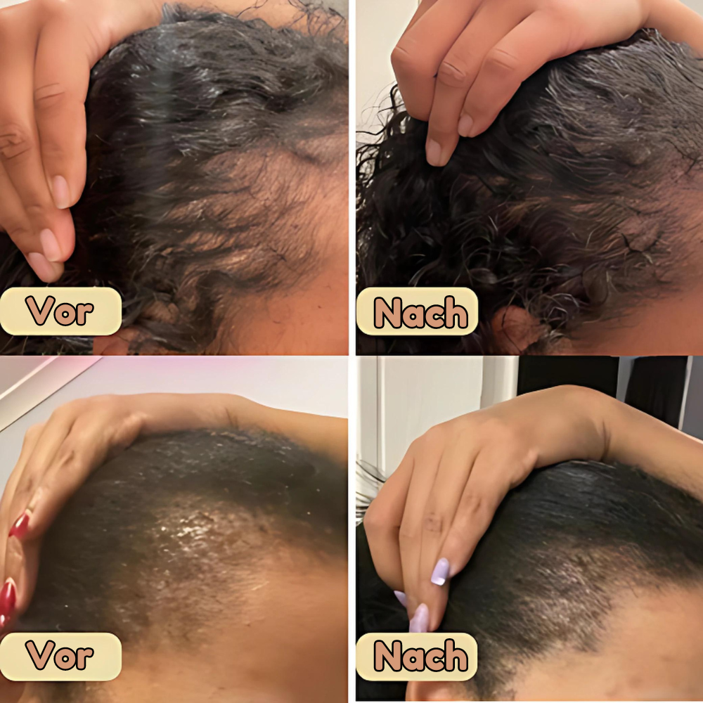 Veganic™️ - Natürliches Haarwuchsöl