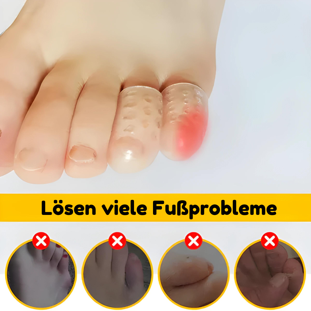 ToeSoft™️ - Zehenschutz aus Silikon (5+5 GRATIS)