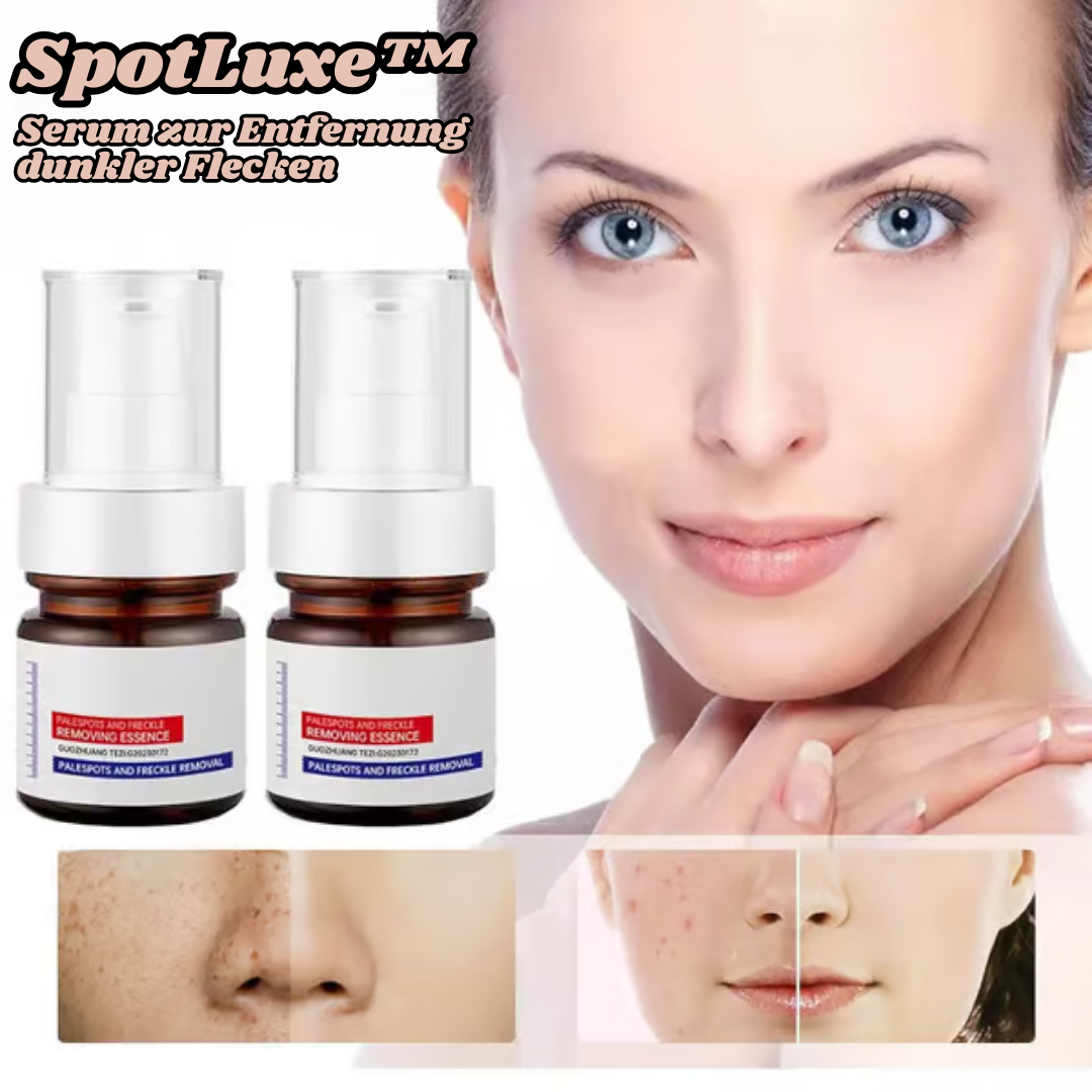 SpotLuxe™ - Serum zur Entfernung dunkler Flecken (1+1 GRATIS)