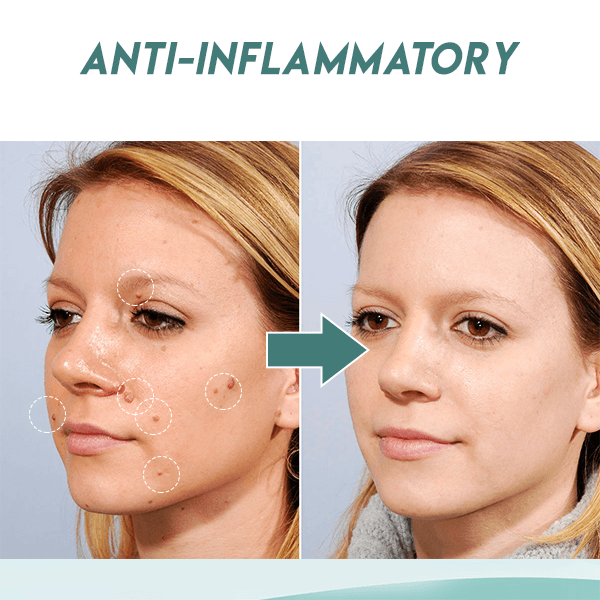 Beauty Patch™ Patch zum Entfernen von Hautflecken (36 Stück)