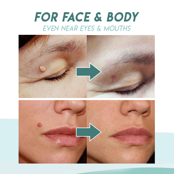 Beauty Patch™ Patch zum Entfernen von Hautflecken (36 Stück)