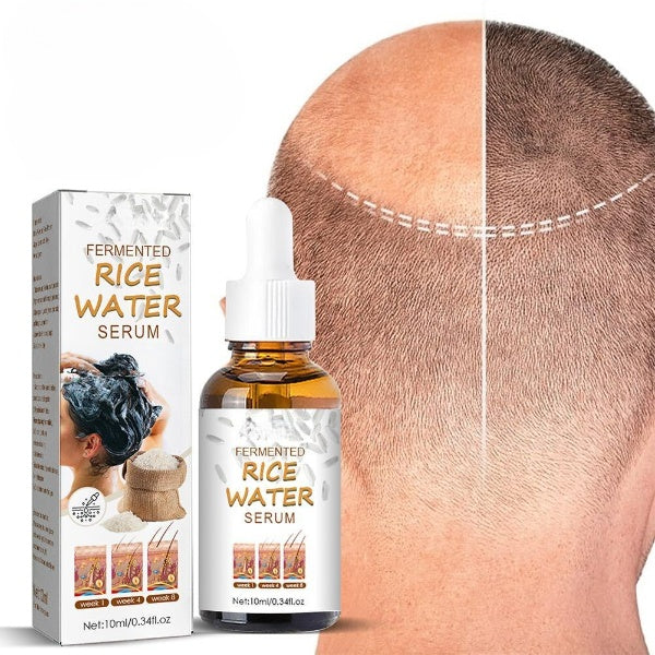 LANTHOME™ - Fermentiertes Reiswasser-Serum (1+1 GRATIS)