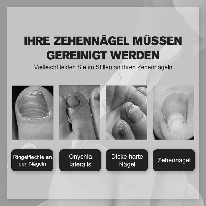 NailHelp™ Medizinische Nagelknipser