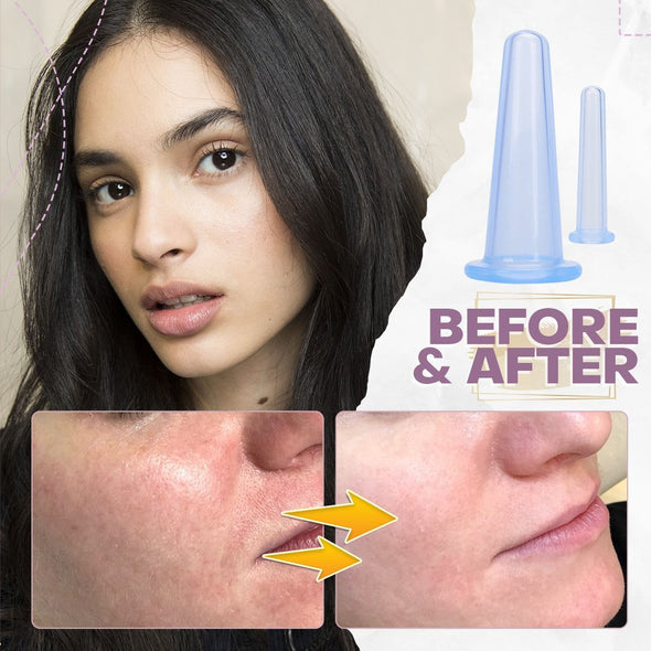 FaceCupp™ - Schröpfen-Kit für das Gesicht (1+1 GRATIS)