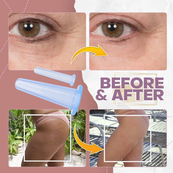 FaceCupp™ - Schröpfen-Kit für das Gesicht (1+1 GRATIS)