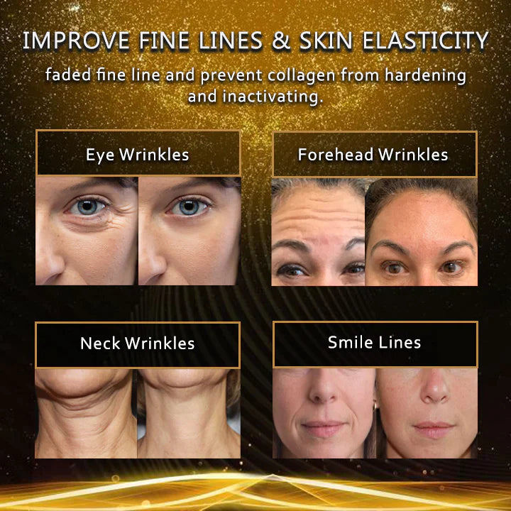 LinesAway™ Fulleren-Plazenta-Essenz (1+1 GRATIS)