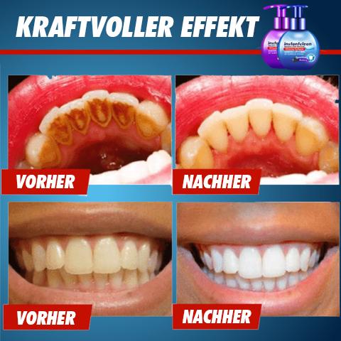 Clean Tooth™ Zahnpasta zur intensiven Fleckenentfernung