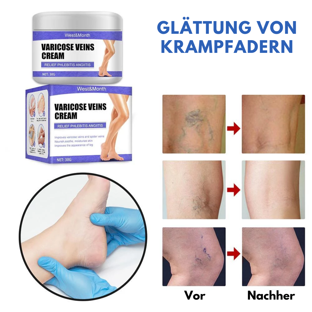 West&Month™ Creme zur Behandlung von Krampfadern