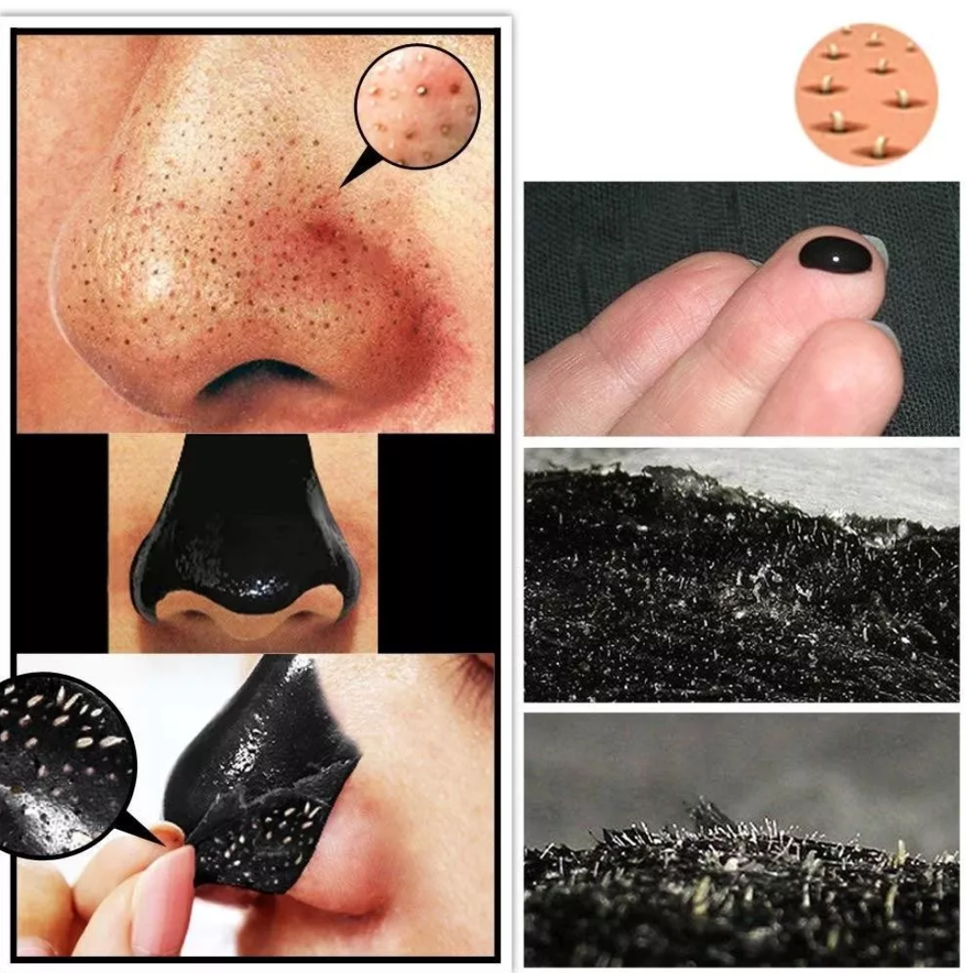 BloomGlow™ Mitesser-Gesichtsmasken (1+1 GRATIS)