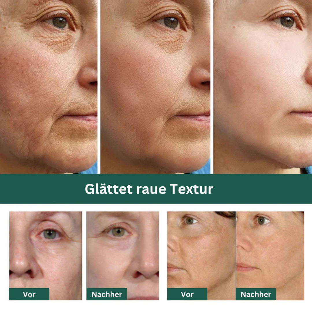 EELHOE™ Anti-Aging-Serum (1+1 GRATIS)