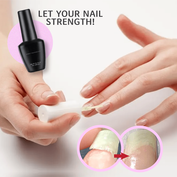 Nail Protect™ Nagelreparatur Protect Gel (1+1 GRATIS)