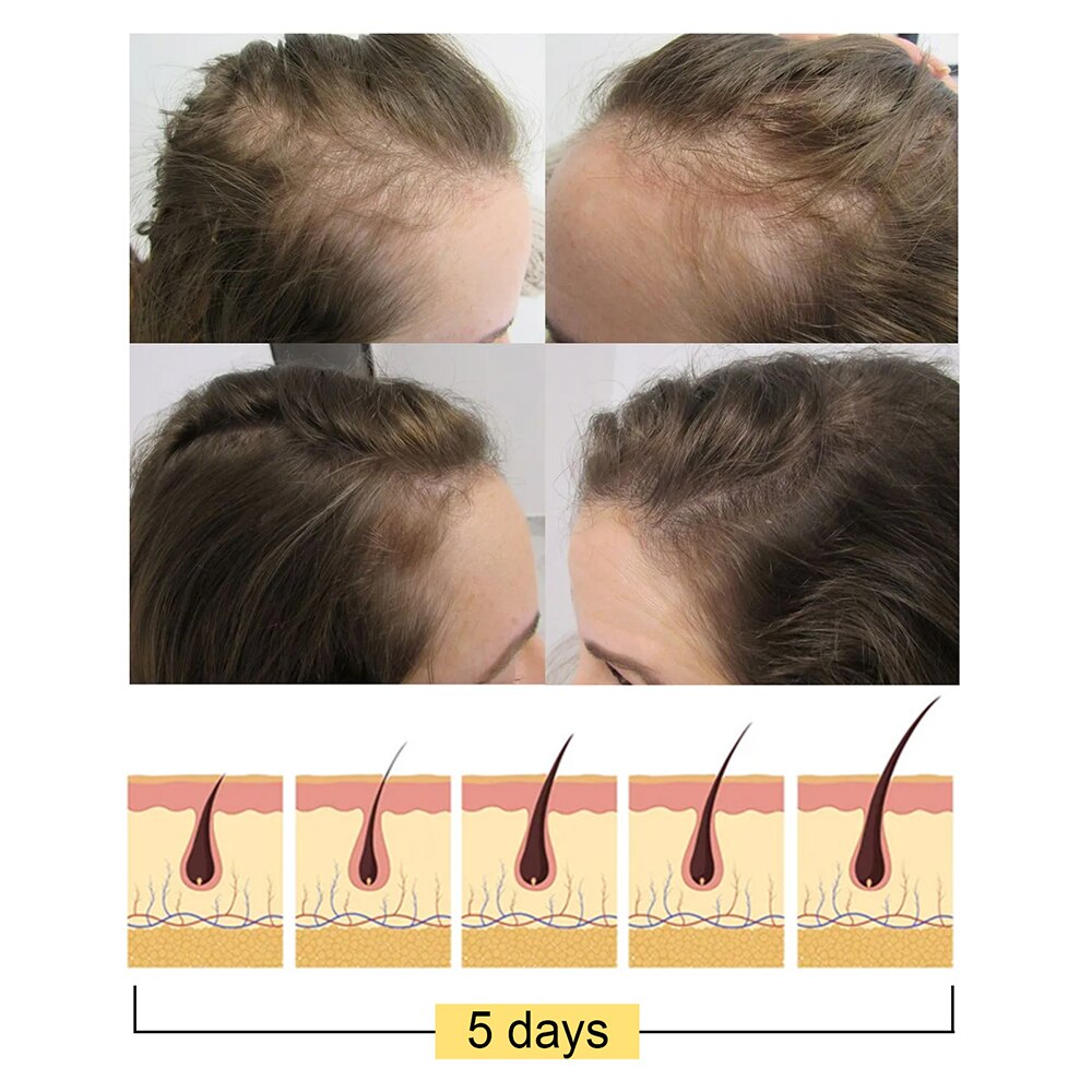 HairBar™ - Anti-Haarausfall Reis Shampoo Bar