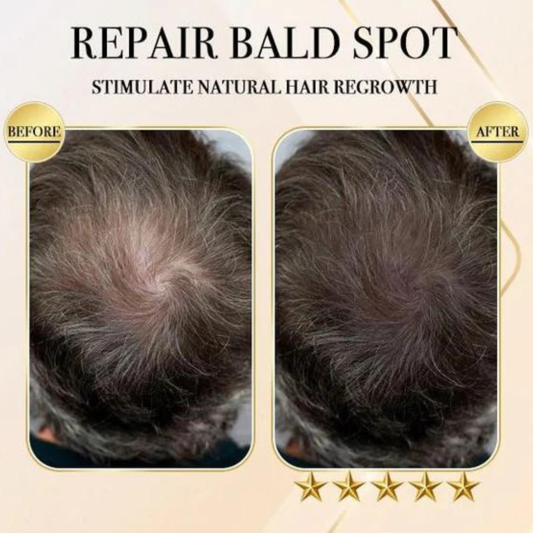 HairCare Bar™️ Ingwer Haarwuchs Shampoo Bar (1+1 GRATIS)