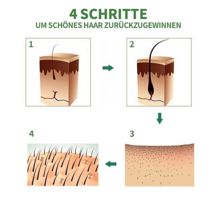 Hair Cure™ Ingwer Haarwachstum Essenz