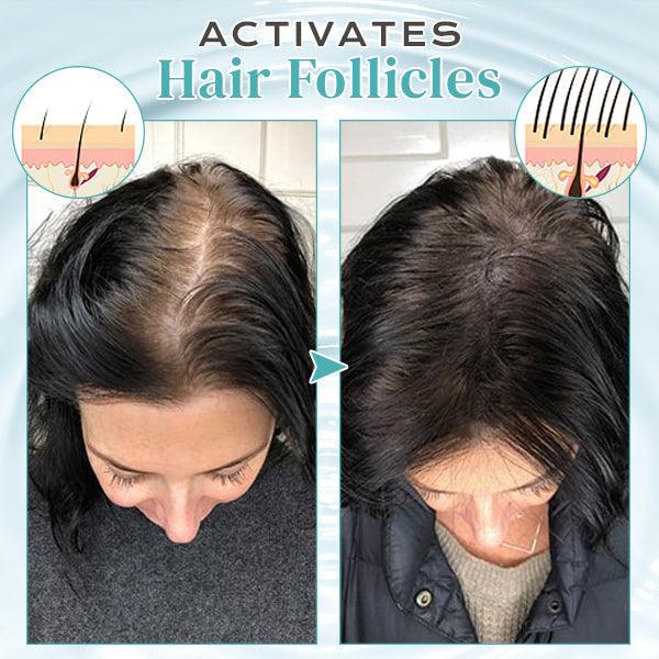 Hair Repair™ Ingwer-Haarwachstumsspray (1+1 GRATIS)