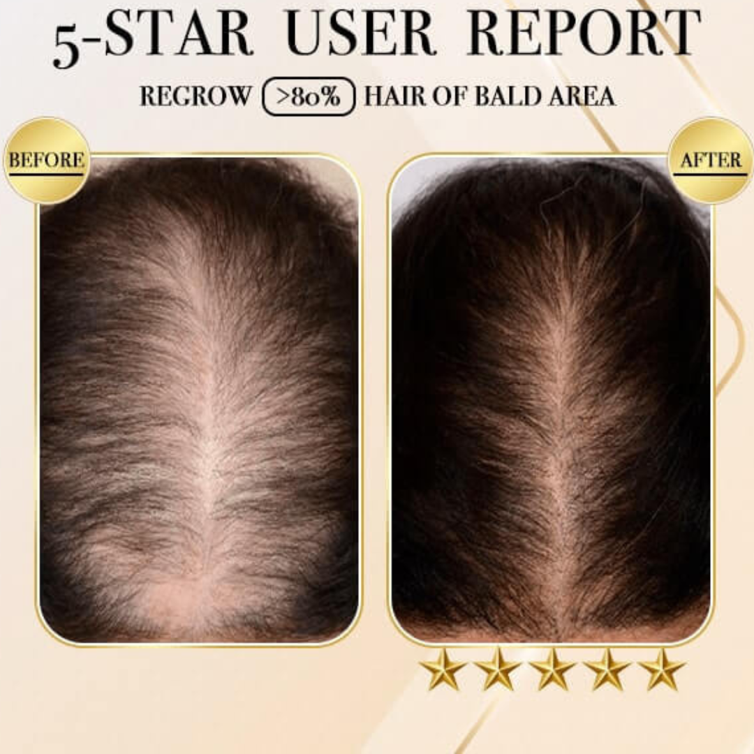 HairCare Bar™️ Ingwer Haarwuchs Shampoo Bar (1+1 GRATIS)