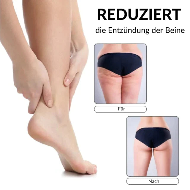 SlimAnklet™ Anti-Schwellungs-Armband (1+1 GRATIS)