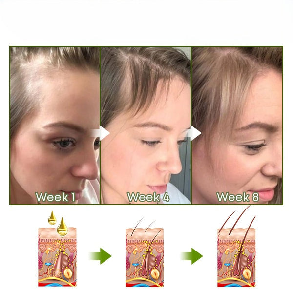 HyunGang™ Serumspray für wiedergeborenes Haar | 1+1 GRATIS