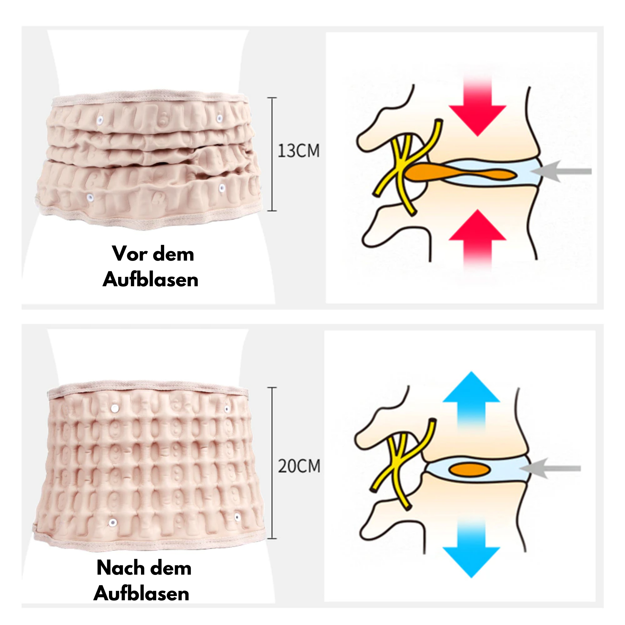 LumbarFit™ Dekompressionsgürtel zur Linderung von Rückenschmerzen