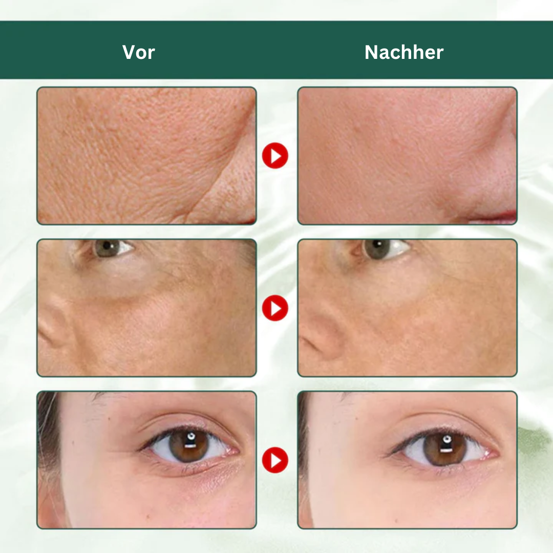 EELHOE™ Anti-Aging-Serum (1+1 GRATIS)