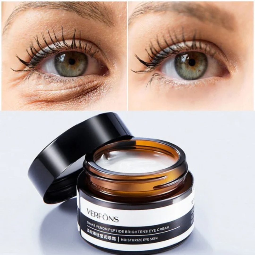 VERFÔNS™️ Feuchtigkeitsspendende Augencreme | 1+1 GRATIS