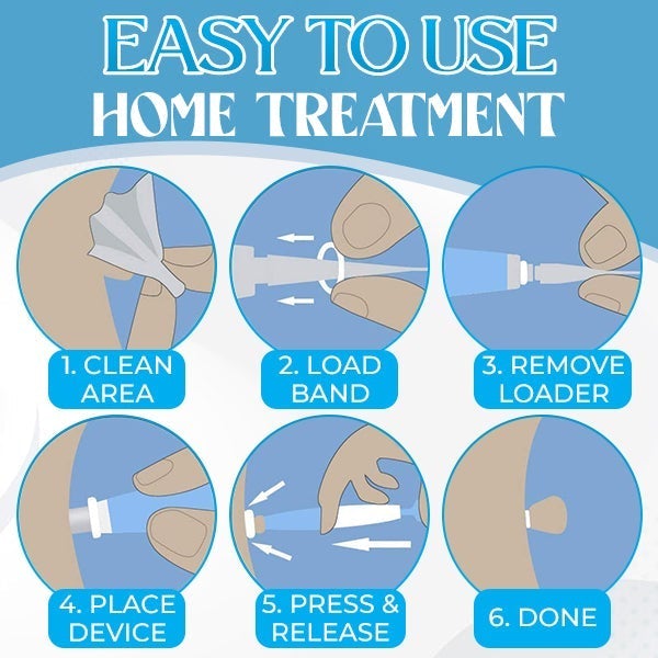 PureSkin™ Hauttag Entferner