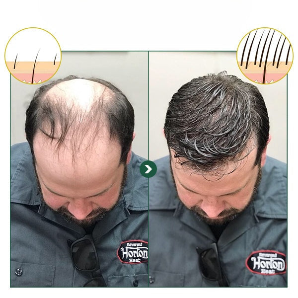 HyunGang™ Serumspray für wiedergeborenes Haar | 1+1 GRATIS