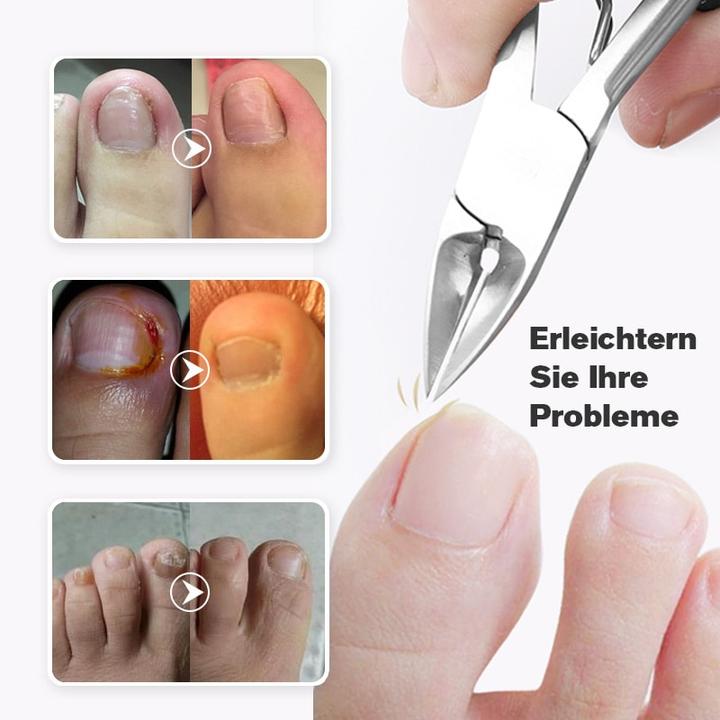 NailHelp™ Medizinische Nagelknipser