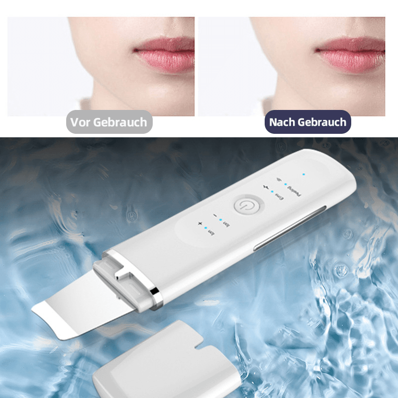 Beauticity™ Ultraschall Ion Gesicht Reinigungsschaber