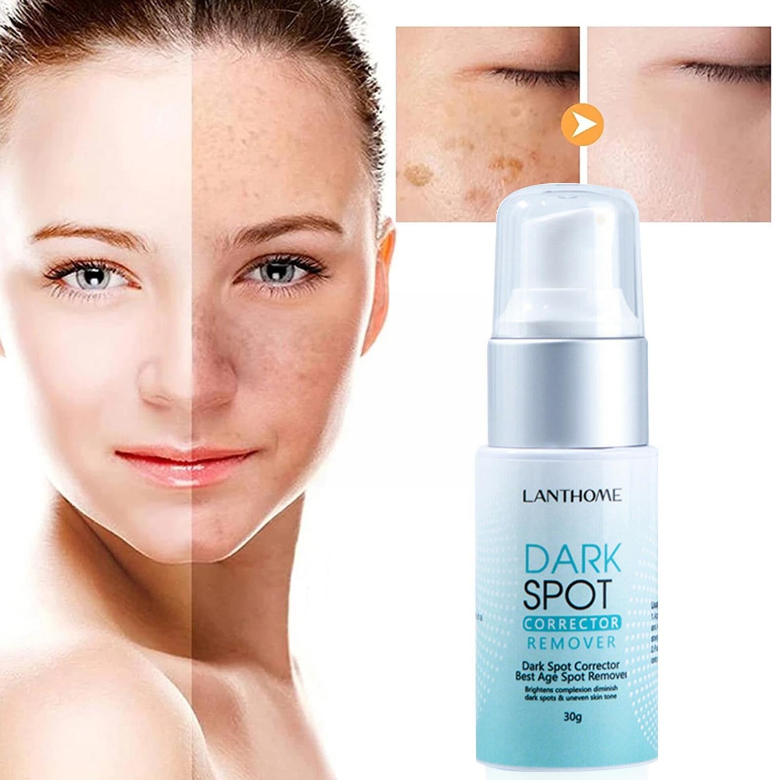 Spotless™️ I Korrektor zum Entfernen dunkler Flecken