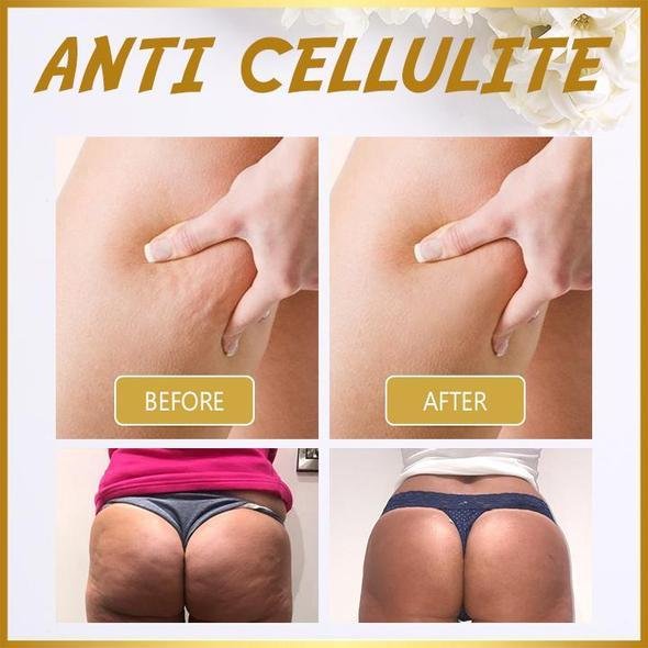 BellyOFF™ - Schlankheits Massageöl (1+1 GRATIS)