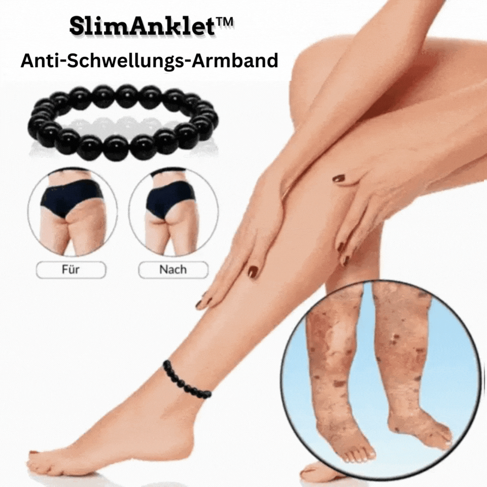 SlimAnklet™ Anti-Schwellungs-Armband (1+1 GRATIS)