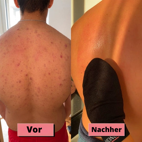 BodyFresh™ - Peeling Körperhandschuh (Satz von 5 Stück)