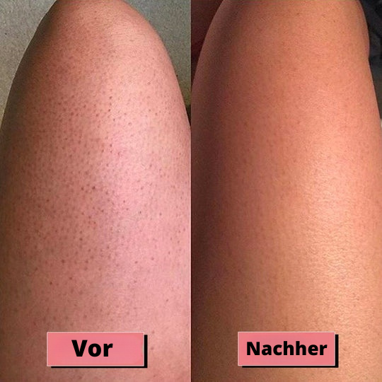 BodyFresh™ - Peeling Körperhandschuh (Satz von 5 Stück)