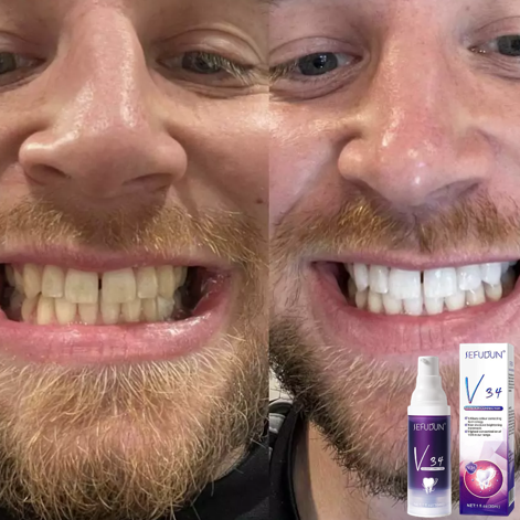 Sefudun® - Farbkorrigierende Zahnpasta (1+1 GRATIS)