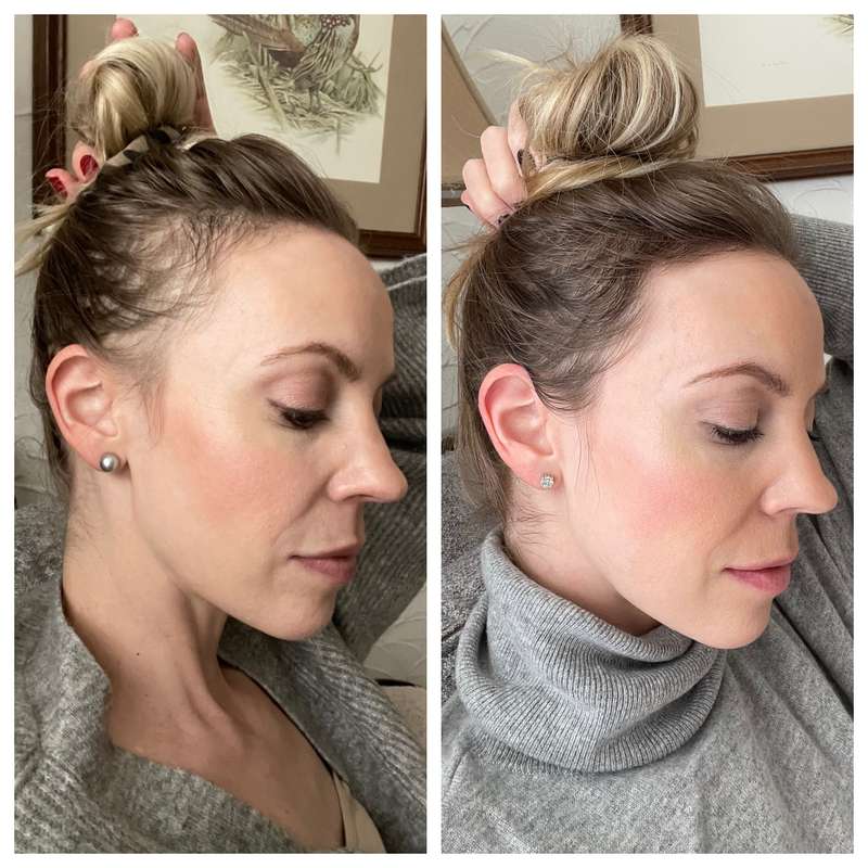 HairBar™ - Anti-Haarausfall Reis Shampoo Bar