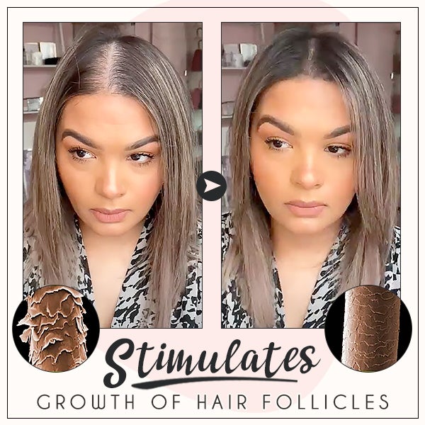 RevivePro™ Hair Boost Ingwer-Creme (1+1 GRATIS!)