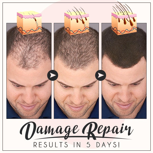 RevivePro™ Hair Boost Ingwer-Creme (1+1 GRATIS!)