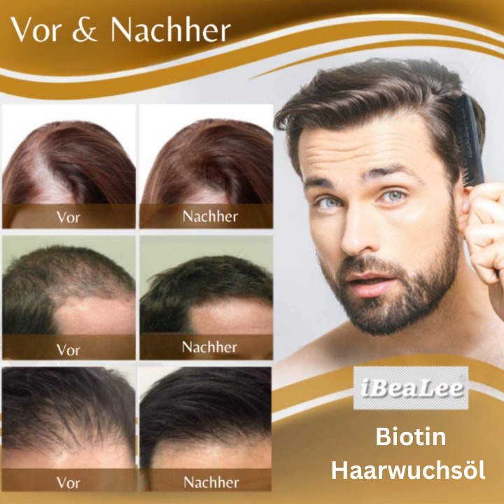 iBeaLee® I Haarwuchsöl (1+1 GRATIS)