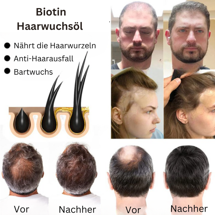iBeaLee® I Haarwuchsöl (1+1 GRATIS)