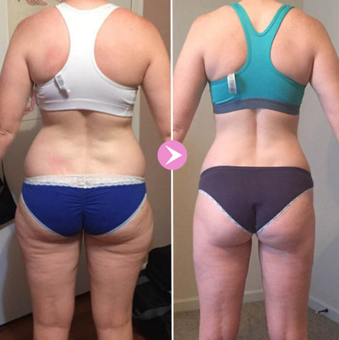 Miracle Bar™️ I Straffende Seife gegen Cellulite