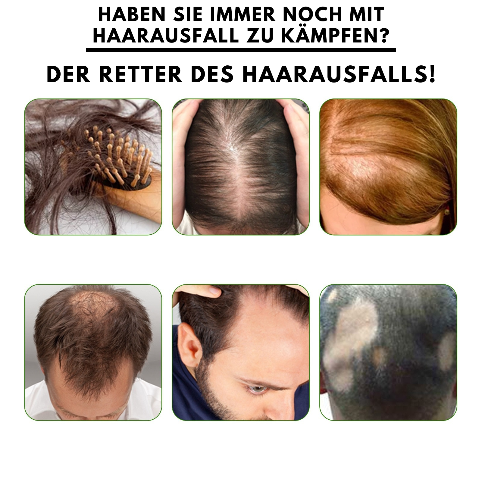 SouthMoon™ - Ingwer Haarwuchs Spray
