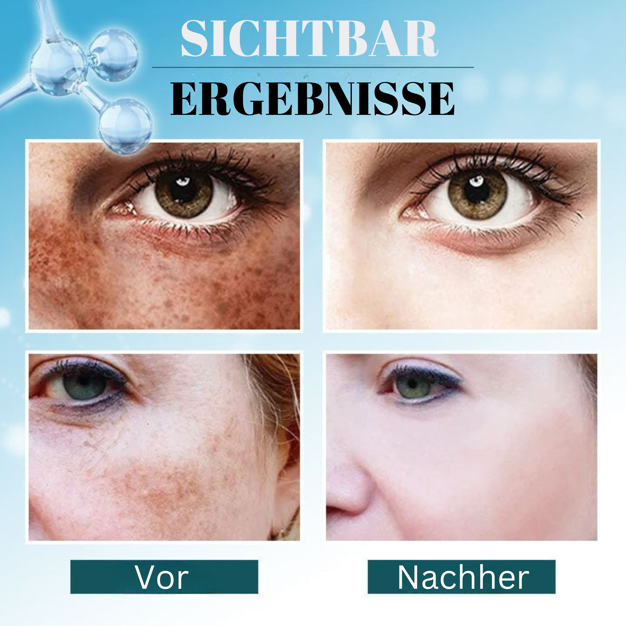 Spotless™️ I Korrektor zum Entfernen dunkler Flecken